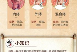 孕期痔疮生完会好吗（产后得了痔疮，怎么治好，去根）