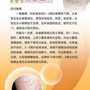 孕妇梅毒对胎儿的影响（孕妇得了梅毒一定会传染给胎儿吗）