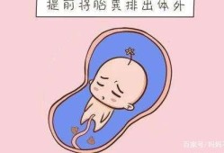 宝宝缺氧孕妇会有什么反应,胎儿在宫内缺氧的症状有哪些