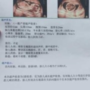 怀孕18周胎儿彩超（怀孕18周胎儿彩超图片）