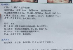 怀孕18周胎儿彩超（怀孕18周胎儿彩超图片）