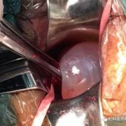 胎儿从哪里出来（宝宝吞了塑料异物会自己排出吗）