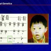 胎儿染色体正常却畸形（胎儿染色体正常却畸形怎么办）