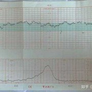 胎儿头偏大如何控制（怀孕35周去检查胎心，说胎头高，没事吧）