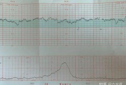 胎儿头偏大如何控制（怀孕35周去检查胎心，说胎头高，没事吧）