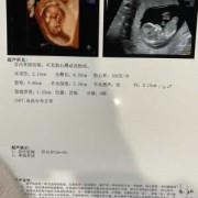 nt主要是检查胎儿什么（nt主要检查胎儿什么问题）