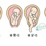 32周胎儿的头在哪里?怀孕32周，臀位怎么办,孕32周胎儿图片真实