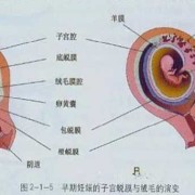 绒毛膜下出血是怎么回事,胎儿绒毛检查能检查出什么