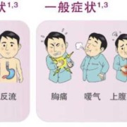 孕期胃灼热（【胃部烧灼感是什么原因】）