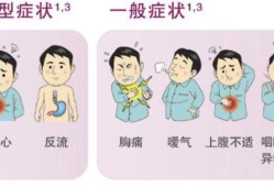 孕期胃灼热（【胃部烧灼感是什么原因】）