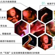 孕期四维彩超（孕期四维彩超几周做最佳时间）
