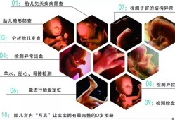孕期四维彩超（孕期四维彩超几周做最佳时间）