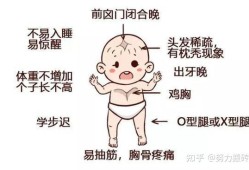 胎儿维生素d（胎儿维生素d不足 有事吗）