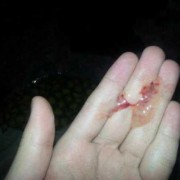 孕期流黑色分泌物（孕期流黑色分泌物图片）