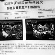 胎儿多大可以做人流（b超显示胎儿多大可以做人流）