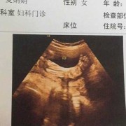 胎儿脚长（胎儿脚长是哪个数据）