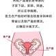 子宫前壁是什么意思,胎儿子宫前壁和后壁哪个好