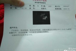 胎儿没有心管搏动（胎儿没有心管搏动）