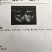 70天没有胎心还能留吗,胎儿没有胎心还会长么