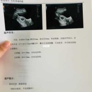 怀孕19周，每次给宝宝测胎心都在肚子左下方，正常吗,胎儿19周发育标准数值