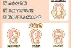 胎儿胎位低（胎儿胎位低有什么影响）