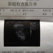 怀孕19周做2维彩超说胎儿胃泡显示不清。怎么办,胎儿胃泡小要注意哪些事项