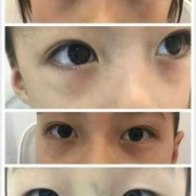 8个月宝宝黑眼圈是怎麽回事,8个月胎儿样子图片