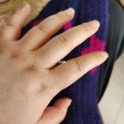 怀孕期手肿（孕31周，手肿怎么办）