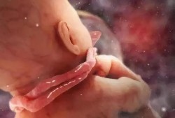 孕妇检查发现胎儿脐带绕颈怎么办,25周胎儿脐带绕颈一圈怎么办