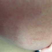 孕期胸部痒（孕期胸部痒是怎么回事）