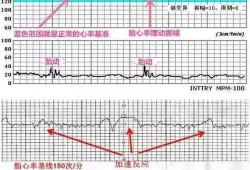 听胎教音乐宝宝就动正常吗,胎心监护怎么让胎儿动起来