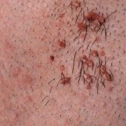 孕期分泌物黄绿色（孕期分泌物黄绿色不痒无异味）