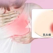 孕期乳头痒怎么缓解（怀孕期间乳头痒怎么回事）