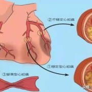 孕期心血管（孕妇心脏供血不足对胎儿有影响吗）