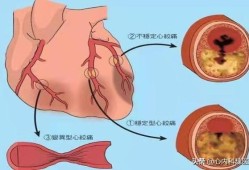 孕期心血管（孕妇心脏供血不足对胎儿有影响吗）