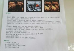 单肾胎儿（四维彩超双肾分离怎么回事）