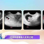 怀孕四个月做唐氏筛查，可以查出胎儿的智商与畸形是不是正常吗,胎儿补脑的最佳3个时间