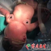 胎儿长肿瘤（胎儿长肿瘤的原因）