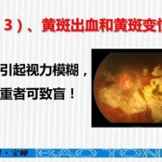 孕期眼睛花，是什么原因,孕期视力模糊怎么回事儿