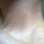 怀孕腋下变黑是什么原因,孕期脖子腋下变黑是生男孩还是女孩