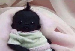 刚出生的婴幼儿的皮肤是都很白吗？为啥我的宝宝皮肤很黑,胎儿黑是什么原因
