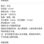 孕37周头位是什么意思,37周胎儿发育标准数据表