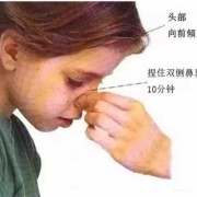 宝宝鼻子出血,孕妇流鼻血对胎儿有影响吗? 已解决
