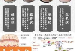 如何去肚子的妊娠纹,孕妇妊辰纹怎么去除