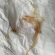 孕期胸涨（孕妇胸涨小腹疼褐色白带的原因是什么）