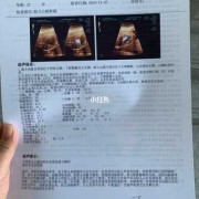 胎儿心脏彩超价格（做胎儿心脏彩超要多长时间）