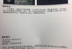 宫腔积液对胎儿的影响（宫腔积液对胎儿的影响过了三个月会减小吗）