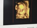 5个月胎儿四维彩超（四维彩超多少钱一次？检查什么）