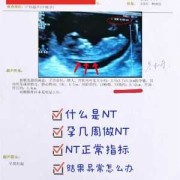 孕期nt检查时间（一般怀孕多久要做nt检查呢？需要多久时间）