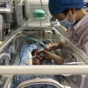 新生儿第一天注意事项？刚刚出生的宝宝要注意什么,新生胎儿图片真实